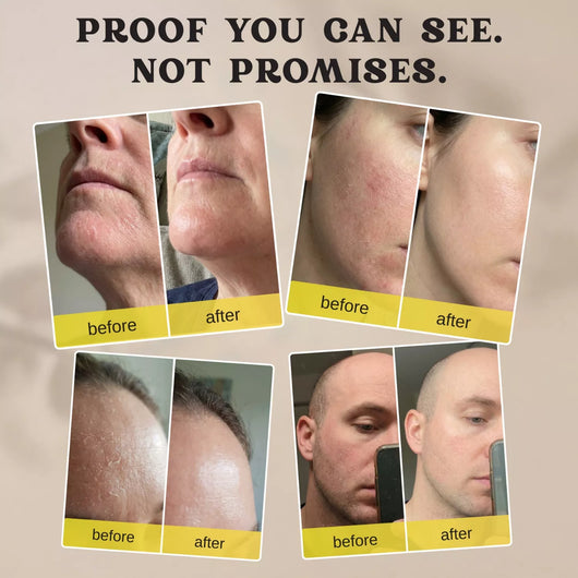 Skin Hydration Cream